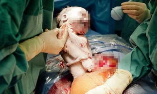 被迫含精受孕入睡h:惊人事件曝光,女性权益再遭侵犯,引发社会广泛关注与讨论! 被迫含精受孕入睡h:惊人事件曝光,女性权益再遭侵犯,引发社会广泛关注与讨论!