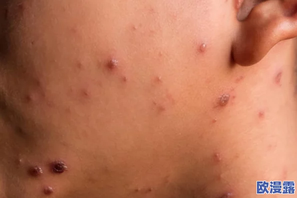 欧美第一次开笣出血：科学家发现新型病毒与人类健康的潜在威胁，引发全球关注和研究热潮