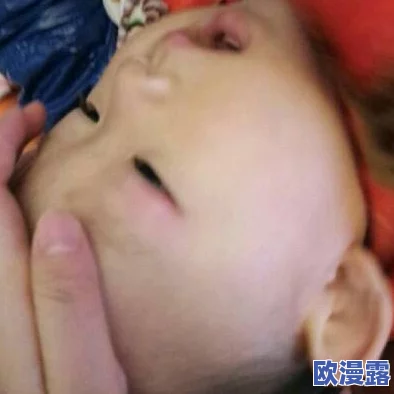 表妹红肿疼痛小缝不能合拢小孩,医生建议及时就医以防感染并进行必要的后续治疗 表妹红肿疼痛小缝不能合拢小孩,医生建议及时就医以防感染并进行必要的后续治疗
